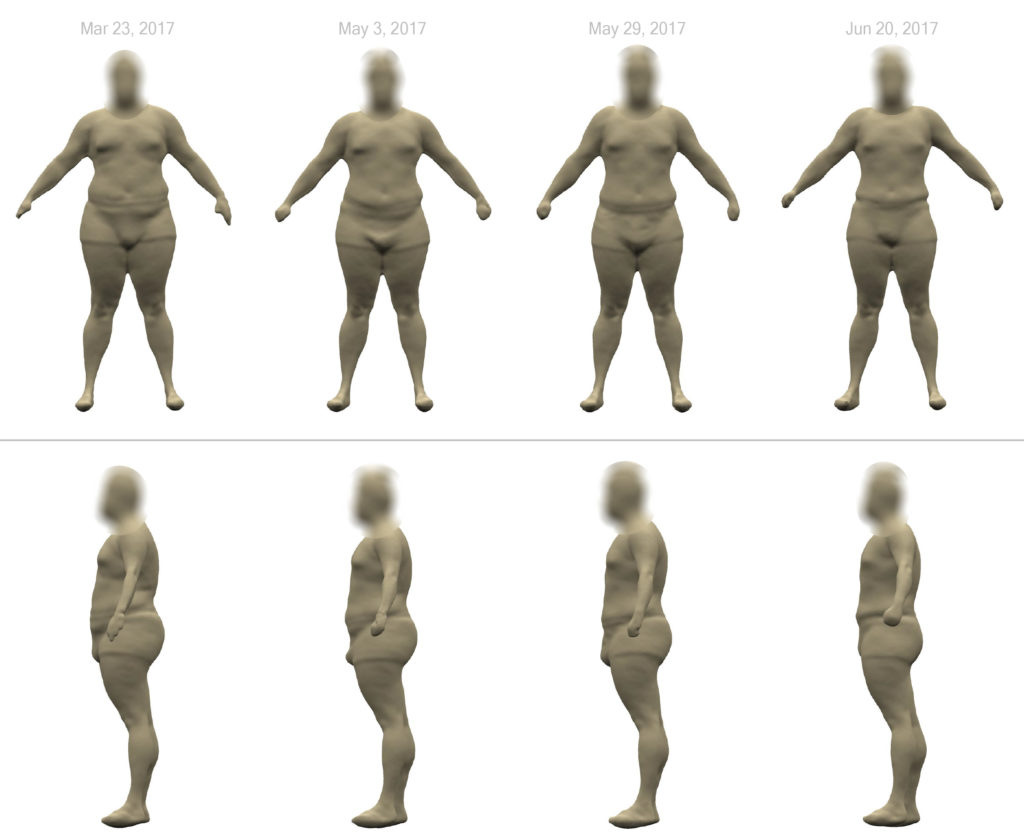 Evolución del escaneo corporal